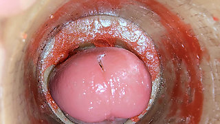 Camera Inside Deep Pussy Captures Big dose Ejaculation of Sperm ASMR