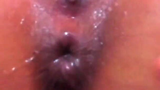 Gaping pussy asshole and prolapse