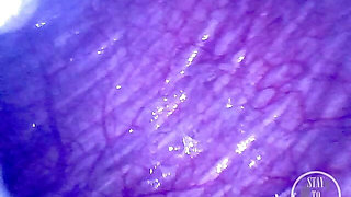 Pumping Air into my full Bladder with the Minicam inside