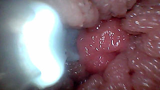 Visual Guide to G-spot Stimulation and Orgasm - Endoscopic Perspective
