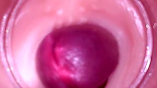 Female Insemination - Internal Camera Captures Deep Male Ejaculation
