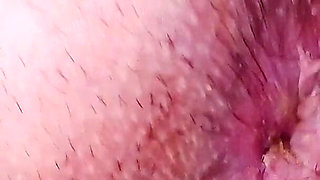 Stinky Hairy Asshole up Close