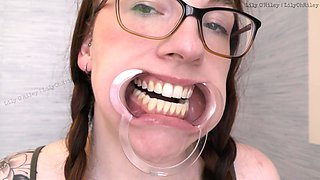 Glasses and Gape: 11-min Dental Speculum-stretched Drool Session