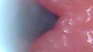 First Time: an Endoscope Reveals the G-spot up Close - Without Mounting!