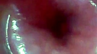 Endoscope POV: Test Tube Cock Urethral Insertion