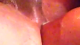 Fistilation_01 - a Fisting Compilation 15min of Extreme Anal Destruction