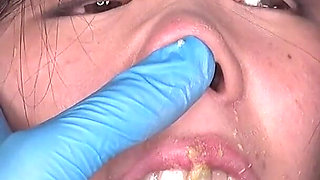 Honoka Sakamoto Trapped: Tongue Clamps, Stretched Face, and No Way Out