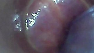 Endoscope POV: Test Tube Cock Urethral Insertion