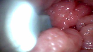 First Time: an Endoscope Reveals the G-spot up Close - Without Mounting!