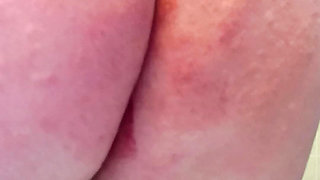 Spanking with stingernettle ,Aftermath