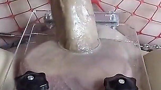 Compilation of Extreme but Effective Sperm Extraction Methods