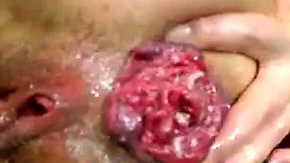 Lesbian Amateur Fisting on Webcam