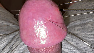 Seven long needles and an orgasm!
