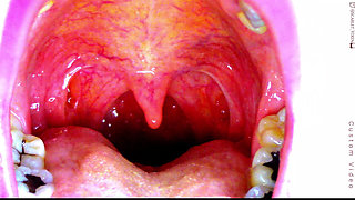 Sexy Scarlet Says Ahhhh - Uvula Showoff