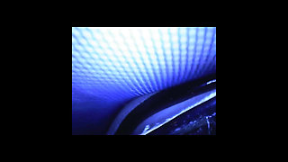 Speculum & Microcamera for Lady Soniac