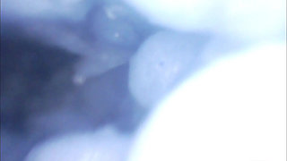 Endoscope Lens Captures Unbearable Pleasure