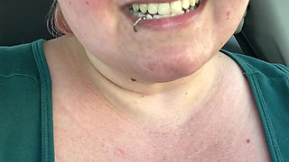 Got a Sunburn for Art Supplies!