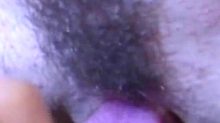 The Surgeon You Don't Pay